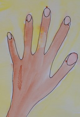 Billede tegnet af Benthe D. M. Bagshaw, der viser punkterne på hænderne hvor man bruger 'tapping' i tankefeltterapi